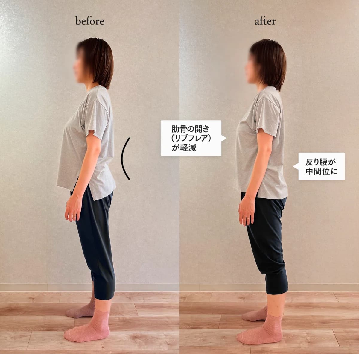 マシンピラティス体験レッスン前後の姿勢比較。肋骨の開きと腰の反りが軽減した一例。結果には個人差あり。
